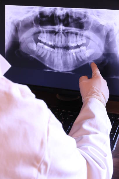 Best Emergency Root Canal Therapy in Windsor, VA